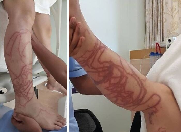 Невидимая сторона человека: 15+ медицинских фото, которые заставляют задуматься